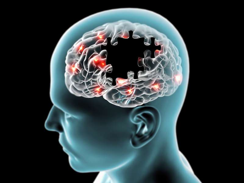 tipologie di depressione
