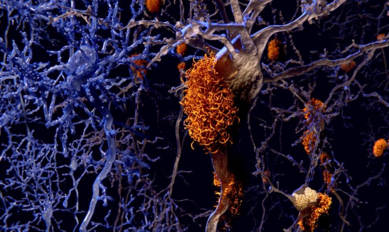 alzheimer una citta anni 50
